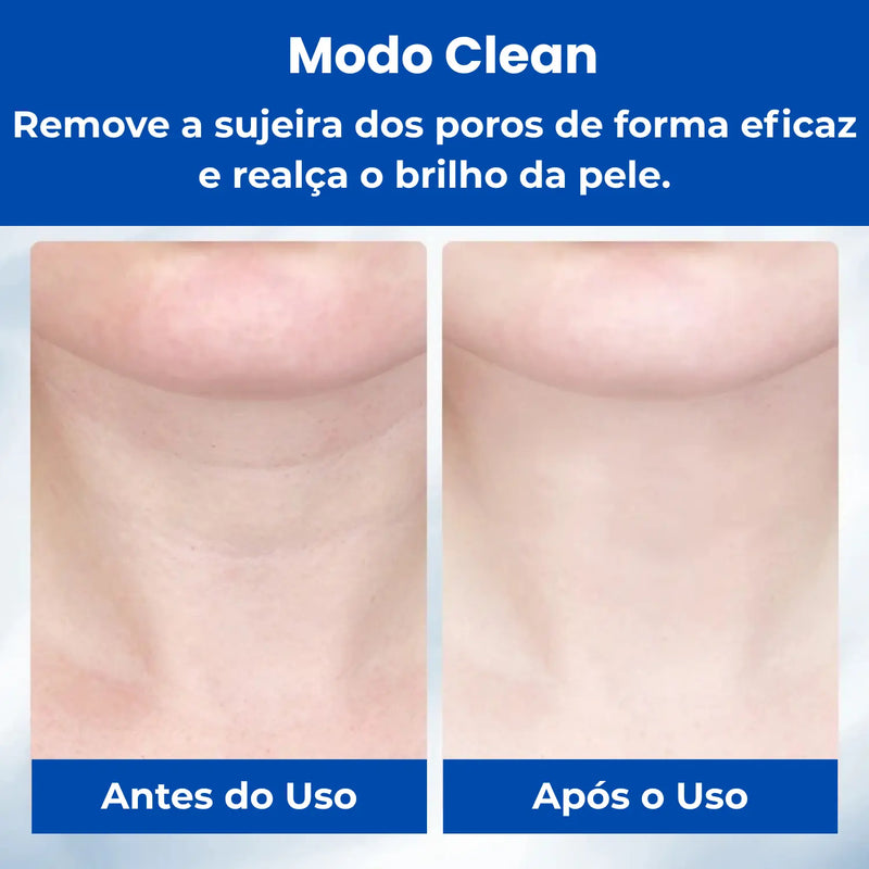 Anlan Neck Care - Massageador de Pescoço Portátil - Loja-TopSpoT